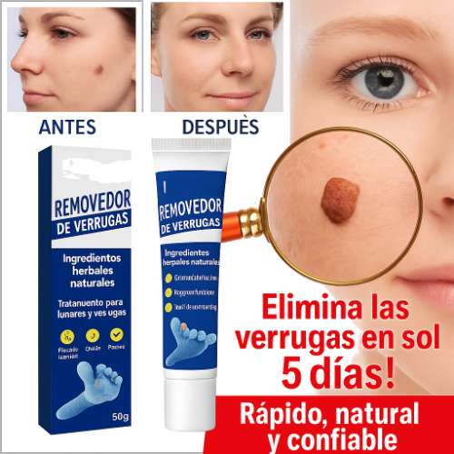 Eliminar verrugas y lunares en rostro manos cuello pecho espalda ingle pies 255703235